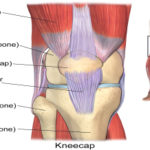OSGOOD-SCHLATTER